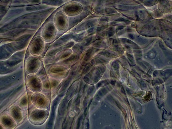 microscopic mushroom_HERO