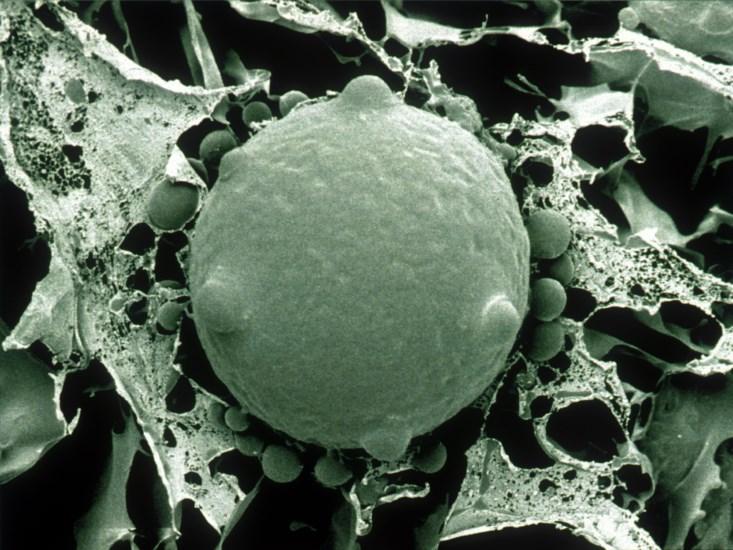 chytrid fungus spore