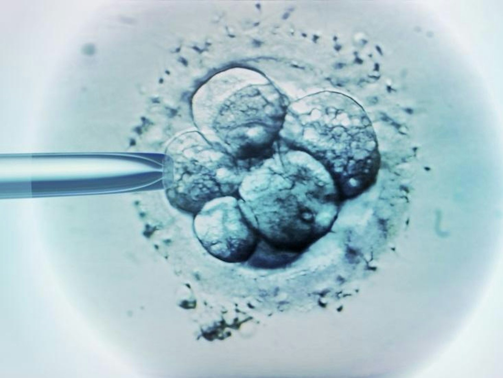IVF embryo selection 