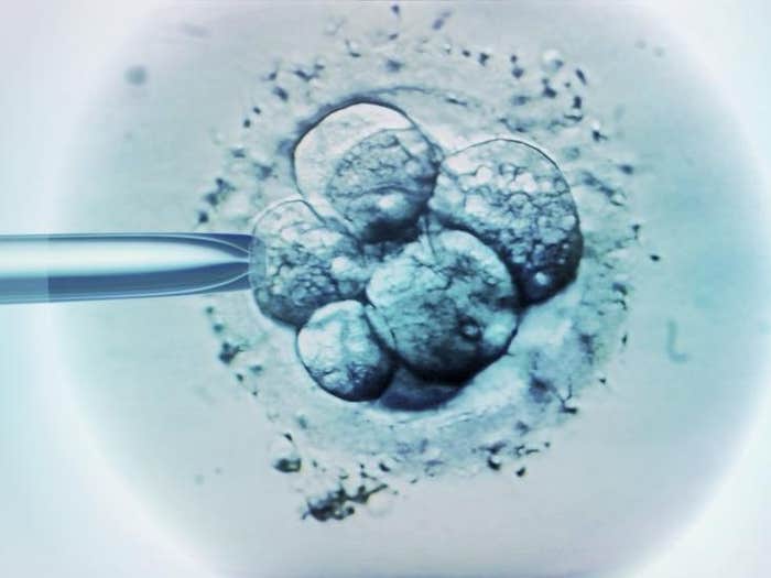 IVF embryo selection