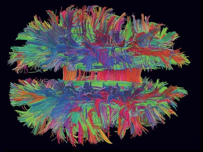 diffusion mri hagmann