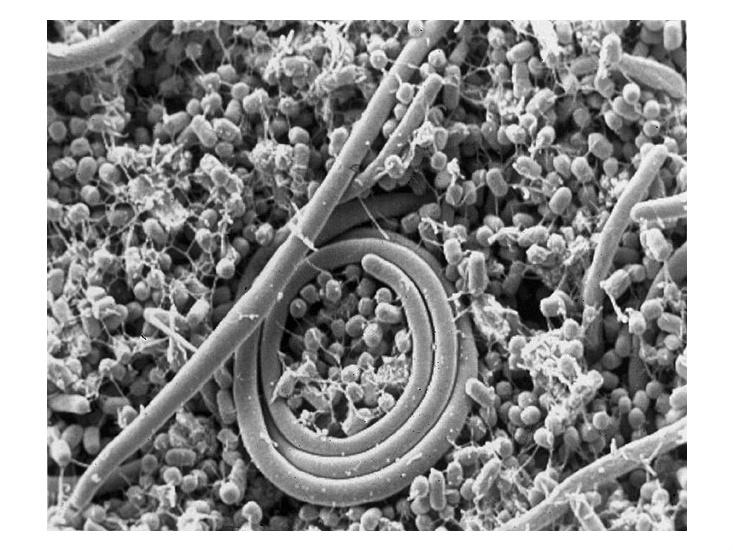 Salmonella enteritidis