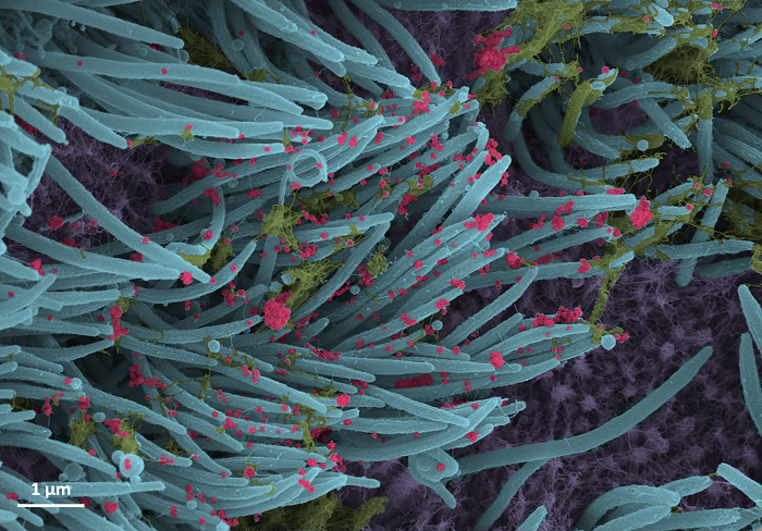 scanning electron lung cells