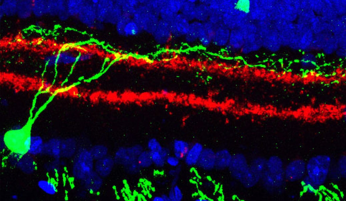 human-retinal-tissue