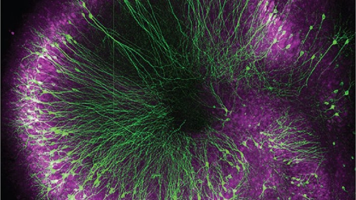 Gene Editing in the Brain Gets a Major Upgrade