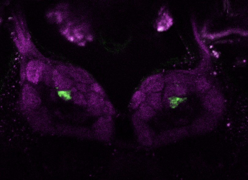 Article Recirculation Lead Image