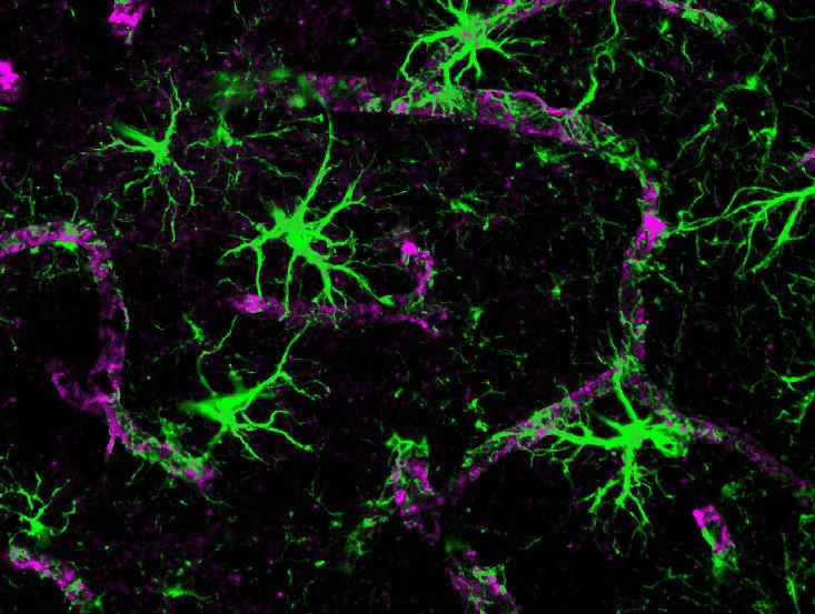Article Recirculation Lead Image