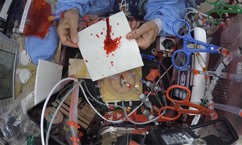 Article Recirculation Lead Image