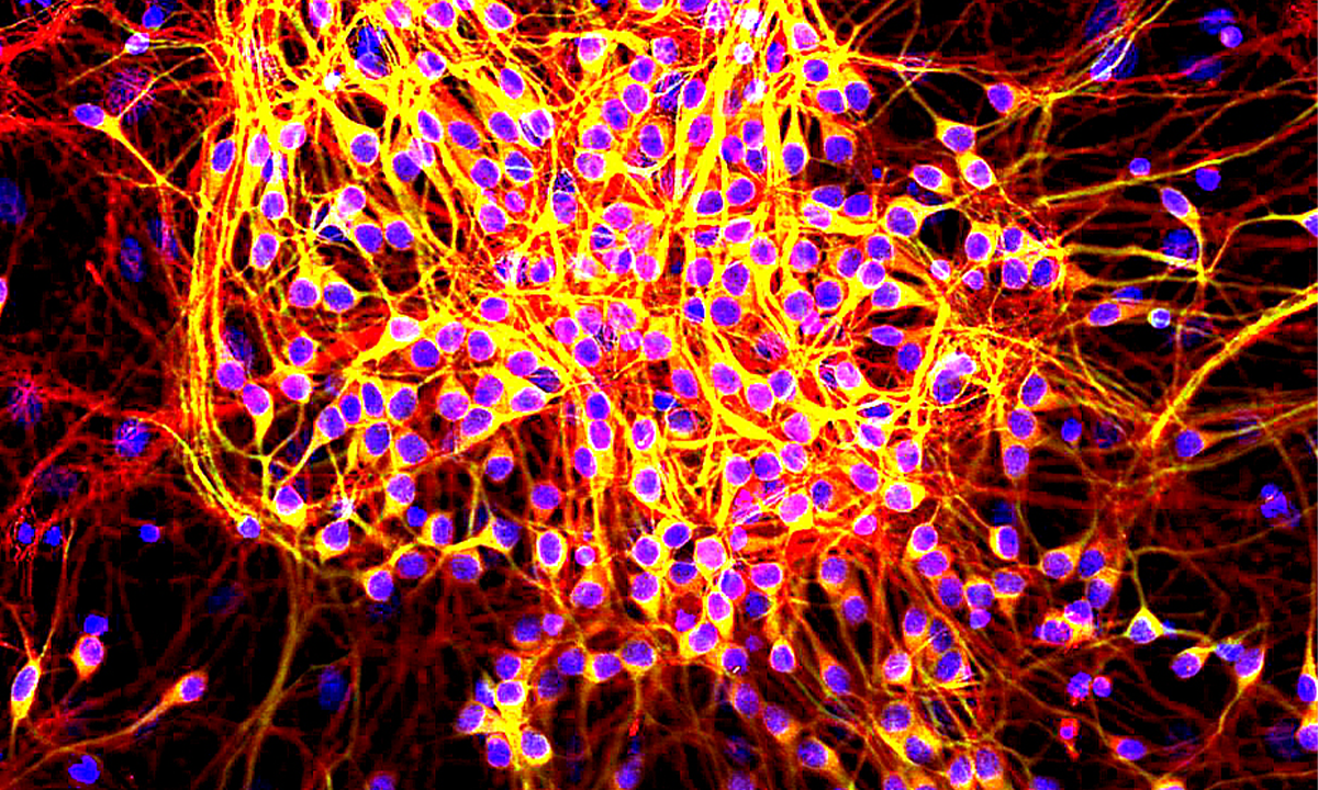 Article Sidebar Image