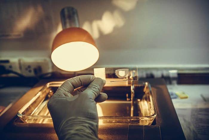 Article Recirculation Lead Image