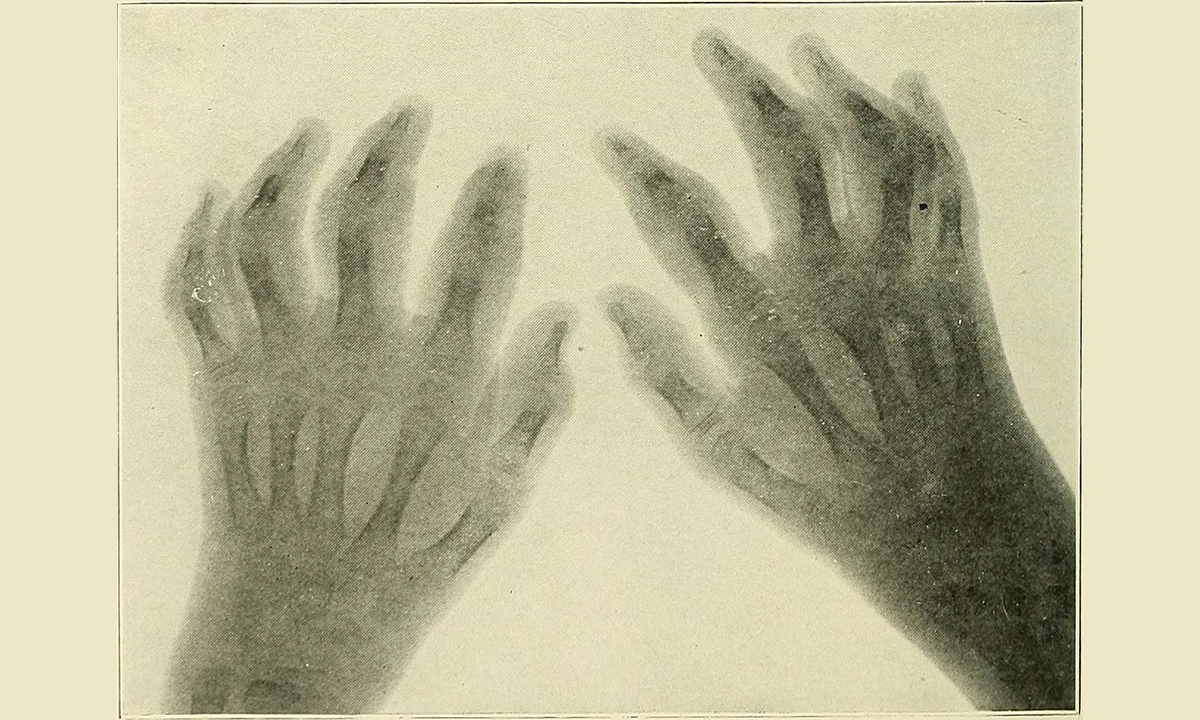 Article Sidebar Image