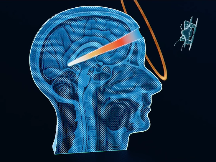 Article Recirculation Lead Image