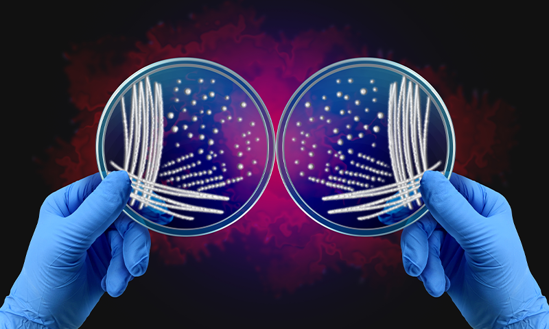 Article Recirculation Lead Image