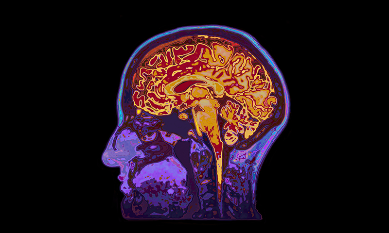 An illustration of a colorful MRI scan of the head and neck, highlighting the brain.