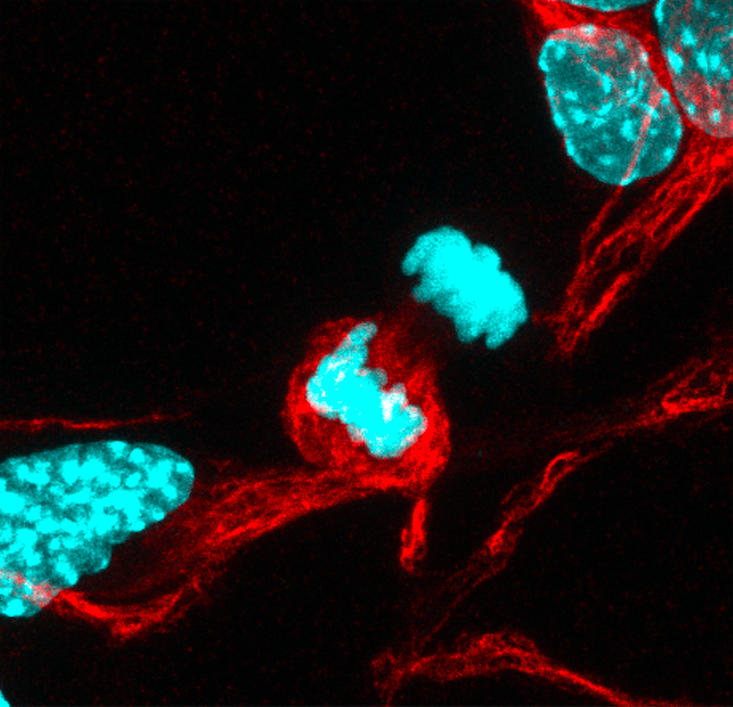 Article Recirculation Lead Image